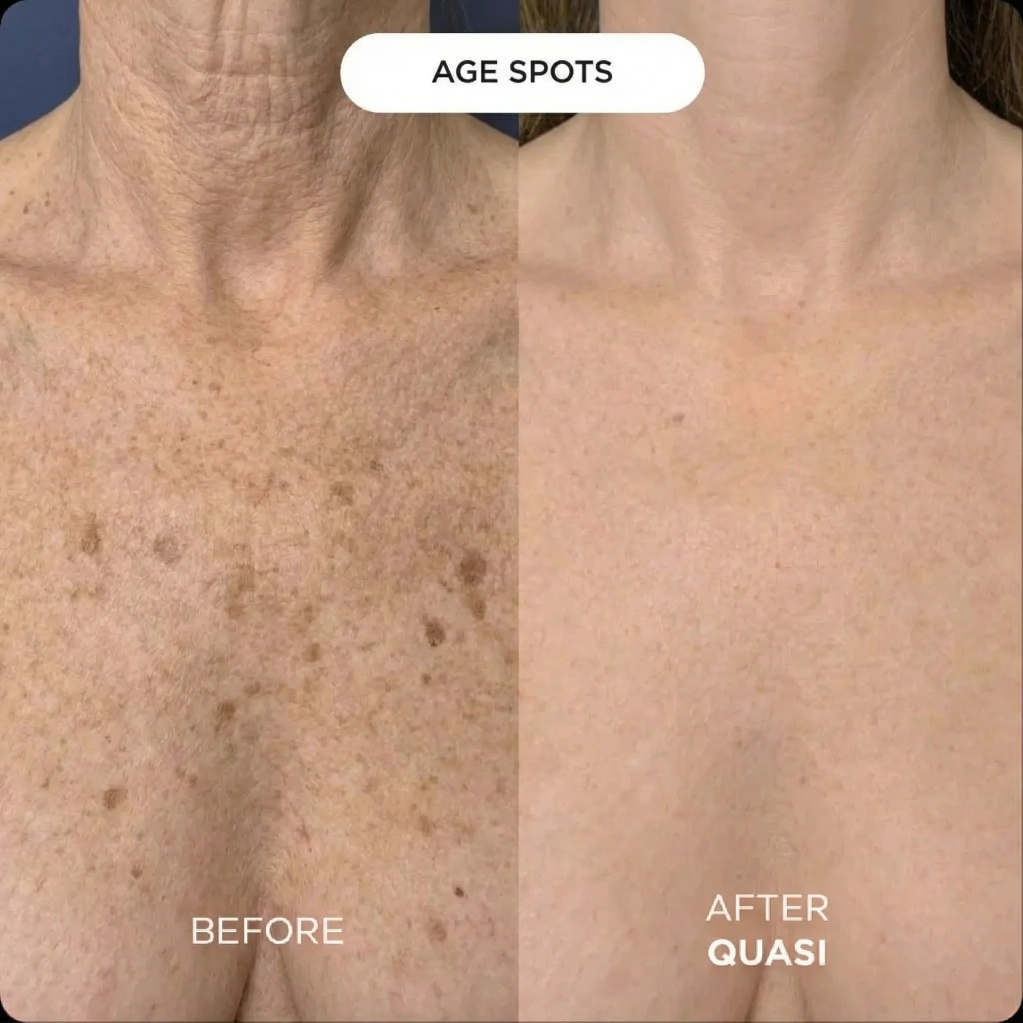 Collagen Chest Mask (free gift) - Image 5