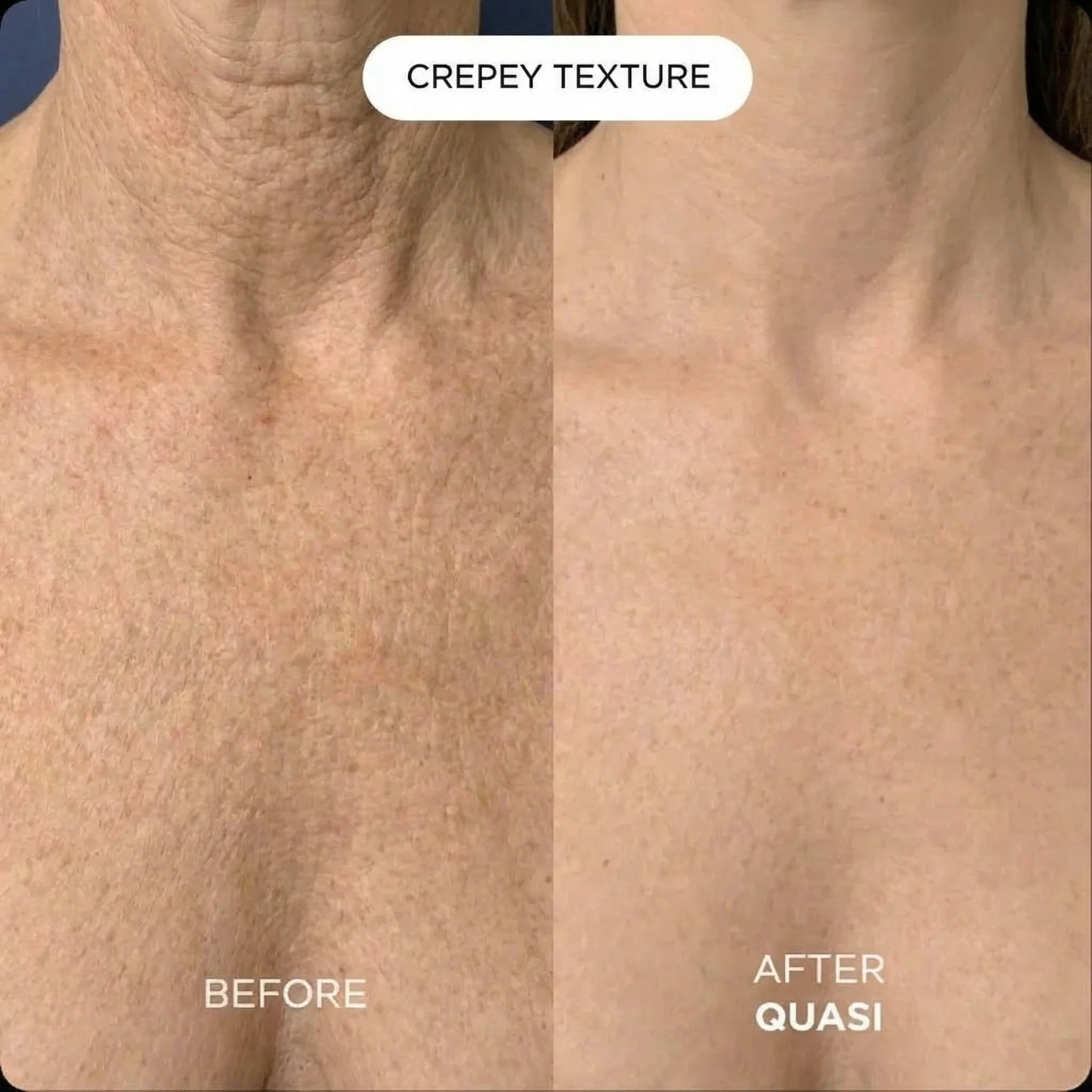 Collagen Chest Mask (free gift) - Image 6