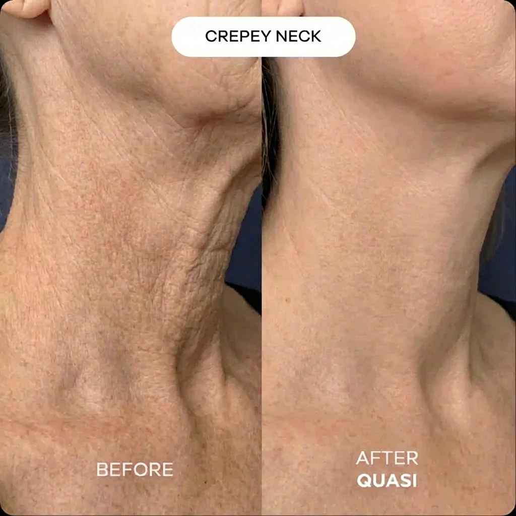 Collagen Neck Mask (free gift) - Image 5