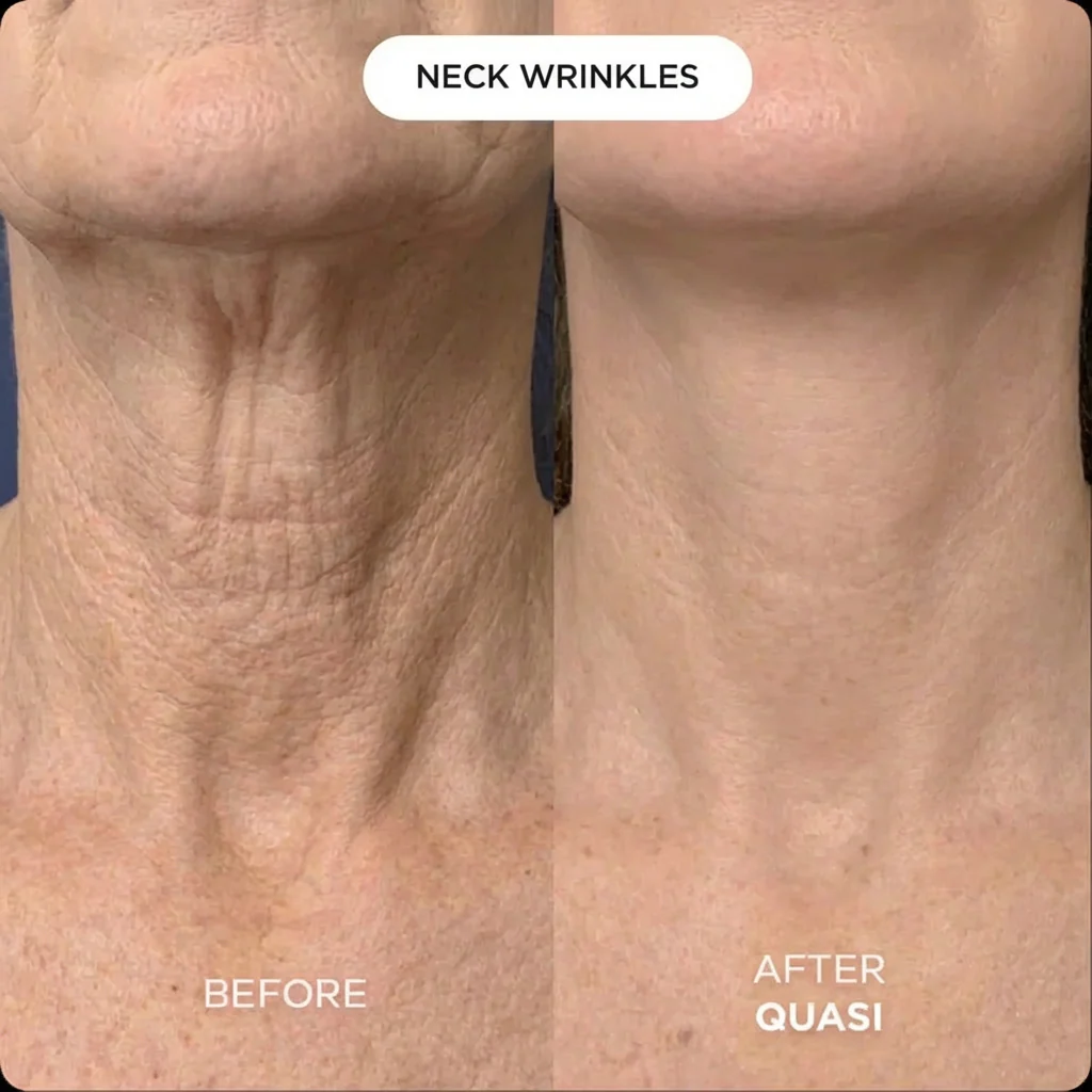 Collagen Neck Mask (free gift) - Image 6