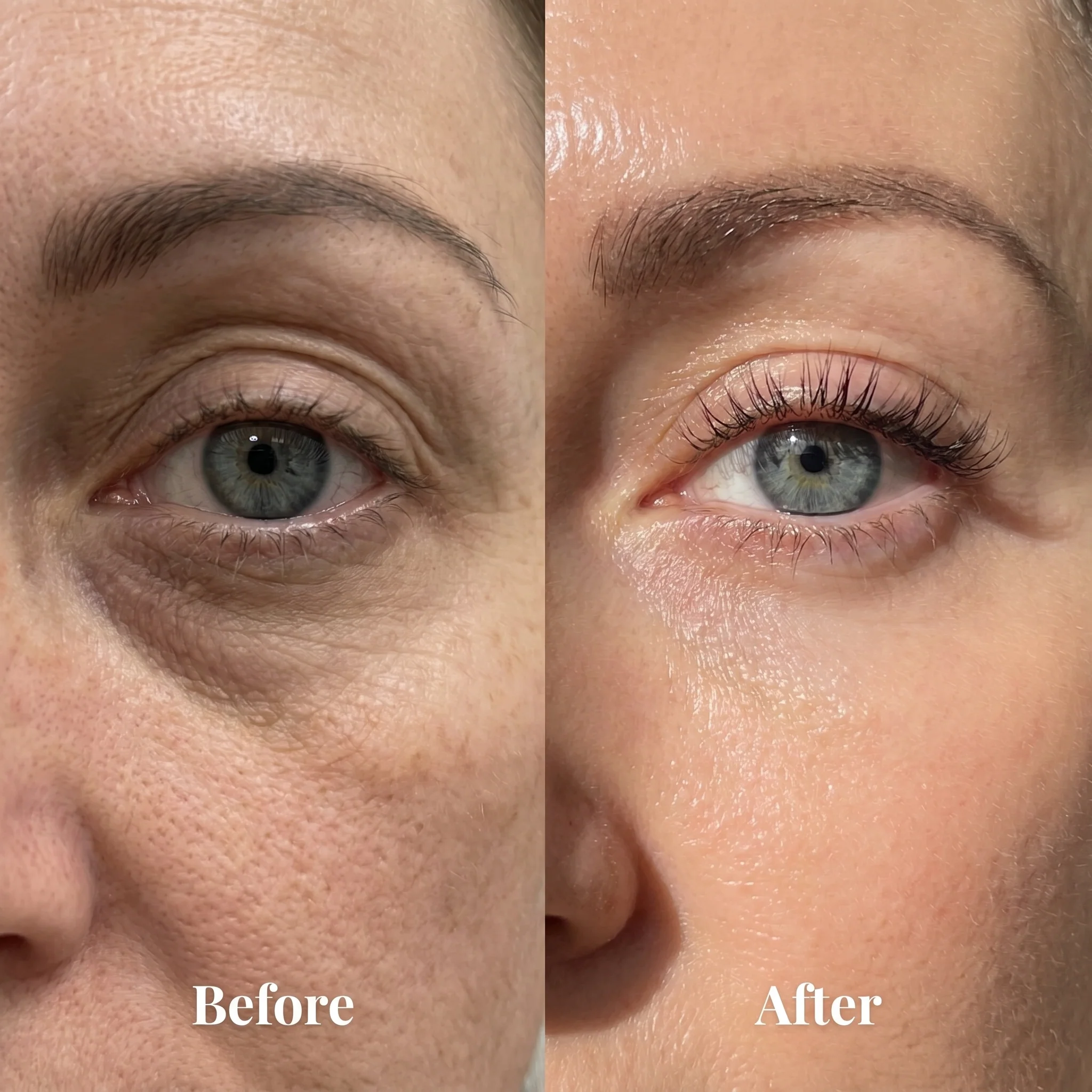 Korean Under Eye Volume Balm - Image 2
